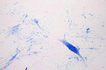 microscope view, giant multipolar neuron, multipolar, neuron, axon, dendrites, central, nervous, system, biology, science