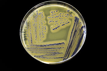food, safety, bacteria, pathogenstaphylococcus, aureus, growing, baird, parker, agar, egg, yolk