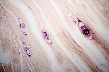 trichinosis parasite, tissue, animal, biology, body, cell, cycle, danger, development, disease, education