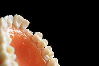dentist, dentistry, orthodontics, decay, tooth