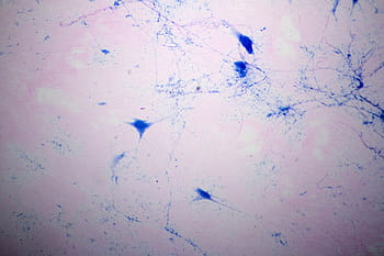 microscope view, giant multipolar neuron, multipolar, neuron, axon, dendrites, central, nervous, system, biology, science